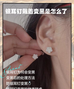 为什么耳环总是会掉？